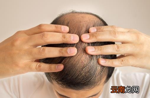脱发厉害是身体出了问题 怎样才能长出浓密秀发