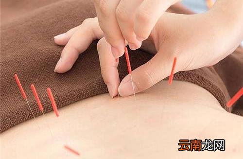 针灸减肥别陷入这些误区