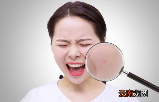 脸上长痘痘究竟是什么原因导致的