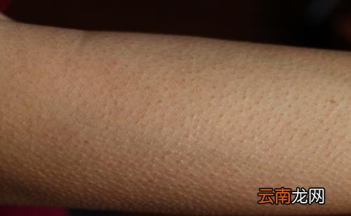 小疙瘩挥之不去的困扰 让皮肤恢复光滑的方法