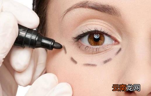 祛除眼袋小方子大推荐 让你今夏眼袋全无年轻十岁