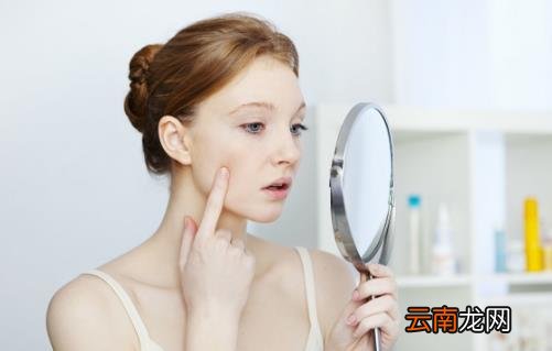 痘印难消很碍眼帮你轻松去除 祛痘疤需要注意的方面