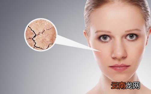 皮肤干燥脱皮帮你搞定它 即刻治愈脱皮护理篇