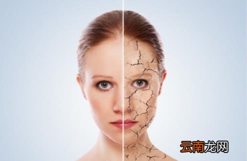 皮肤干燥脱皮帮你搞定它 即刻治愈脱皮护理篇
