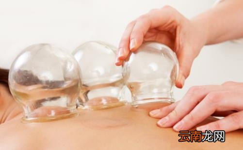 坚持拔火罐到底能不能减肥 颜色深代表毒素多湿气重