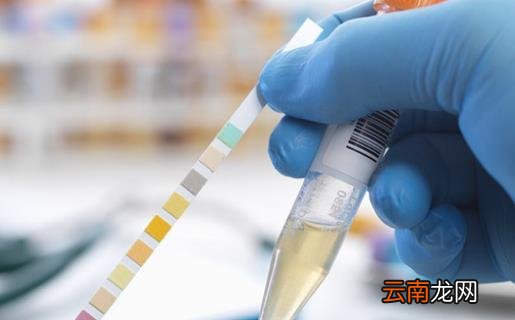 女人怀孕早期症状多怀孕初期7大方面要做到位