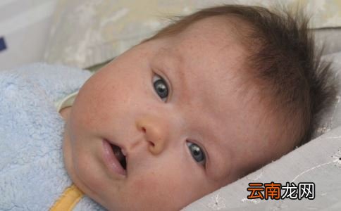 冬天宝宝湿疹的六个原因 该如何护理