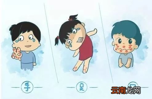 手足口病要怎么预防 手足口病的防治知识