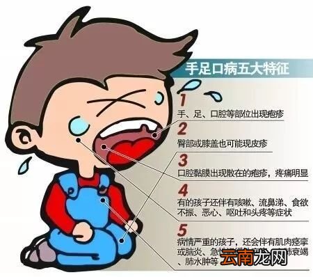 手足口病要怎么预防 手足口病的防治知识