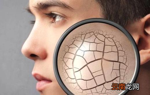 干性皮肤正确使用保湿面膜 干性皮肤日常注意事项
