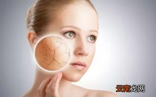 干性皮肤正确使用保湿面膜 干性皮肤日常注意事项