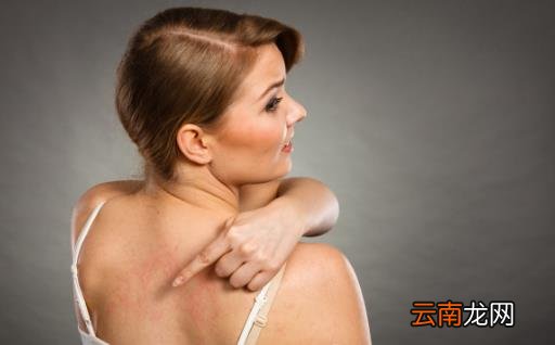 后背成长痘重灾区 背后长痘的解决措施及预防方法