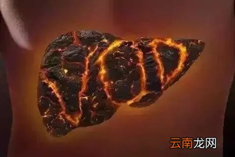 蒲公英的根和叶有什么功效 用对才最重要