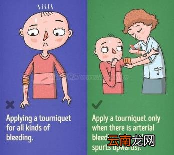 9个错误的急救知识 别让你的善意变成伤害