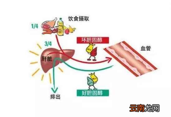 胆固醇高吃什么好 多吃这些降胆固醇好