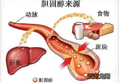 胆固醇高吃什么好 多吃这些降胆固醇好