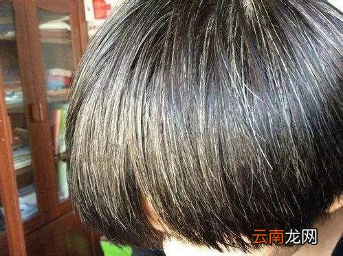 肾气不足的症状表现 肾气不足身体会怎么样