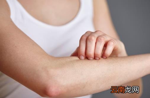 湿疹的危害不能忽视 预防湿疹避免外界各种刺激