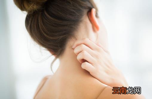 湿疹的危害不能忽视 预防湿疹避免外界各种刺激