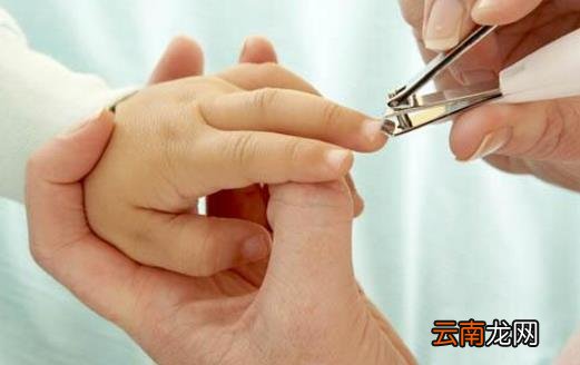 手指出现倒刺 春季护肤必不可少了