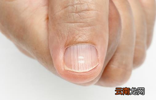 指甲凹陷的日常护理方法 指甲与疾病的预测关系