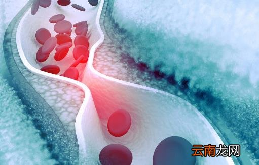 身体出现这4个迹象暗示活不长 口干就是衰老的征兆