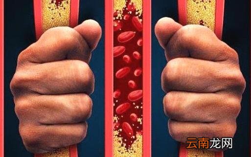 最佳血管养护时间表 养好血管健康更长寿