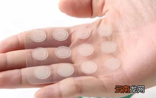 痘痘贴可以去黑头吗 痘贴可以贴一晚上吗