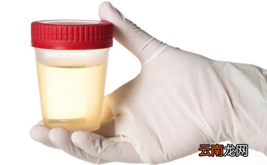 尿液浑浊的原因 教你判断尿液是否浑浊