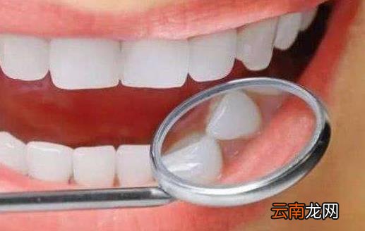 导致牙齿发黄的5大原因 搭配不同的食物进行美白牙齿