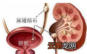 南瓜藤的功效与吃法 南瓜藤竟有这么多好处