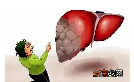 肝脏不好的症状 肝不好的人眼睛会出卖你