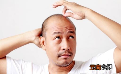 脱发或是疾病引起 防止脱发的最佳六大方法