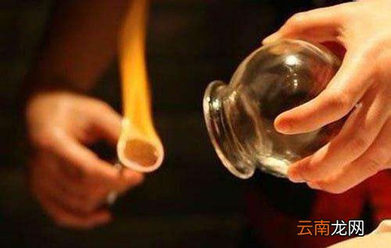 拔罐祛湿位置图 夏天是拔罐去湿气的最好季节