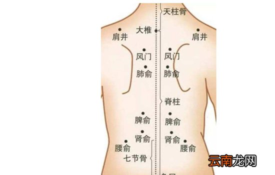 拔罐祛湿位置图 夏天是拔罐去湿气的最好季节