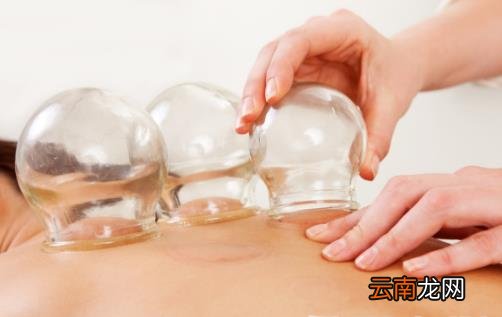 拔火罐并非人人适合 有的人拔火罐等于在自残