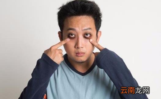 黑眼圈是人体某些疾病的信号 去掉黑眼圈的小窍门