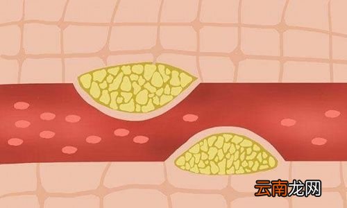 夏天空调怎么开才不会得空调病