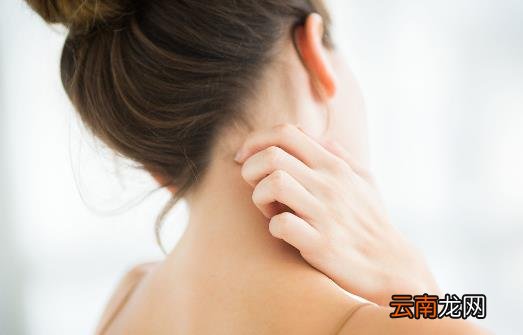 春季易引发的皮肤病 几种方法助你轻松应对