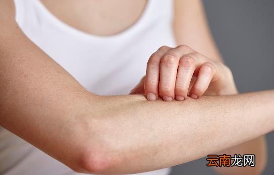 春季易引发的皮肤病 几种方法助你轻松应对
