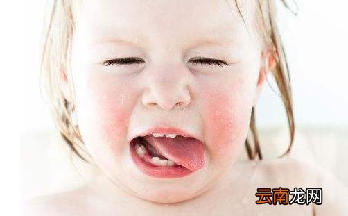 什么是蛲虫病？蛲虫的症状有哪些