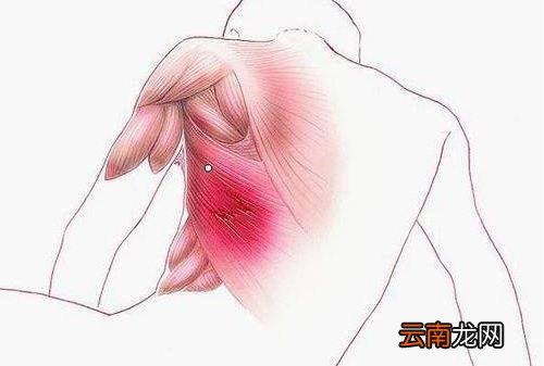 软组织挫伤多久能好？