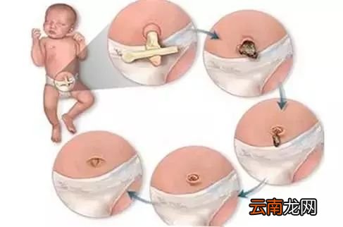 肚脐到底能不能抠 它藏着“生老病死”的秘密