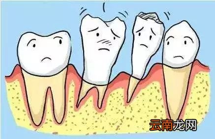 吃东西总塞牙怎么回事 吃东西塞牙的原因