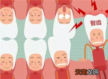 吃东西总塞牙怎么回事 吃东西塞牙的原因