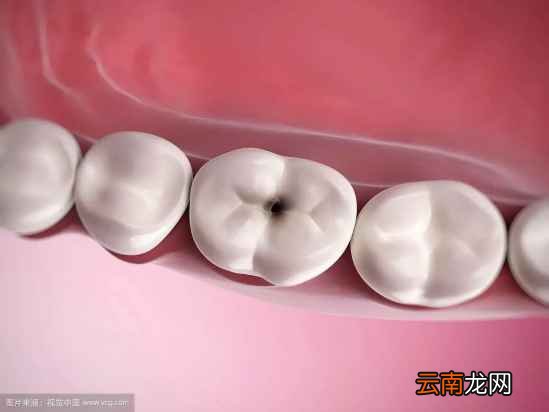 吃东西总塞牙怎么回事 吃东西塞牙的原因