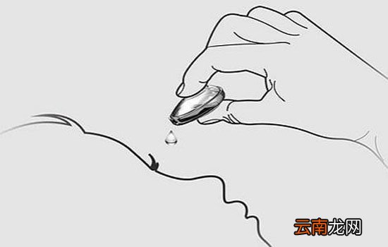滴完眼药水闭眼还是睁眼 滴完不要马上用力闭眼