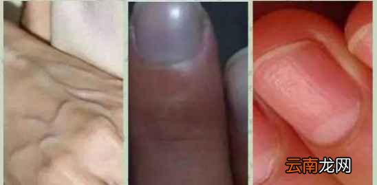 肝脏不好有什么表现 这10个护肝法一定要记住