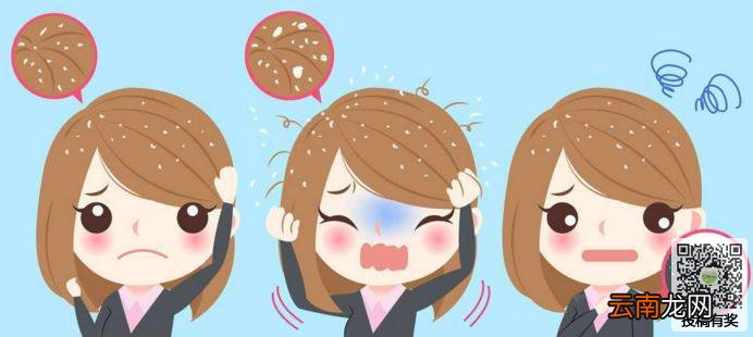 女生青春期为什么会有头皮屑