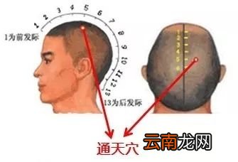 中医治疗鼻炎的方法 怎么有效缓解鼻炎好